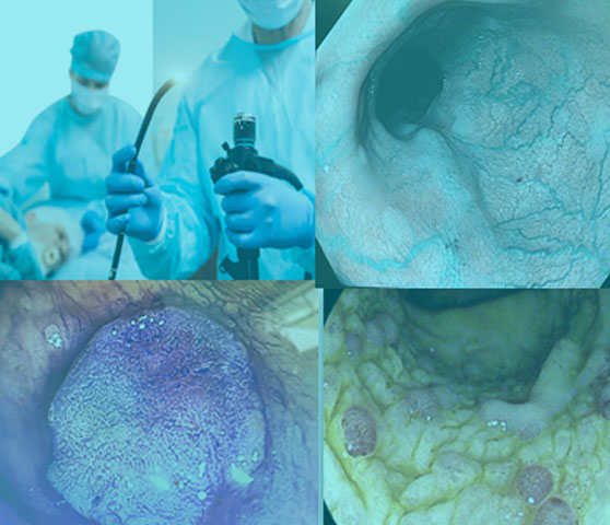 Endoscopia en la CDMX